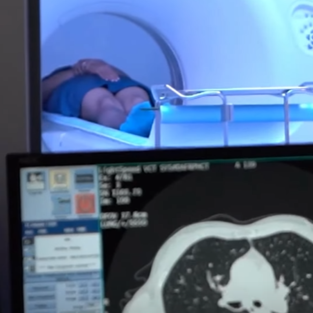 CT Scan - Αξονικός Τομογράφος (video)